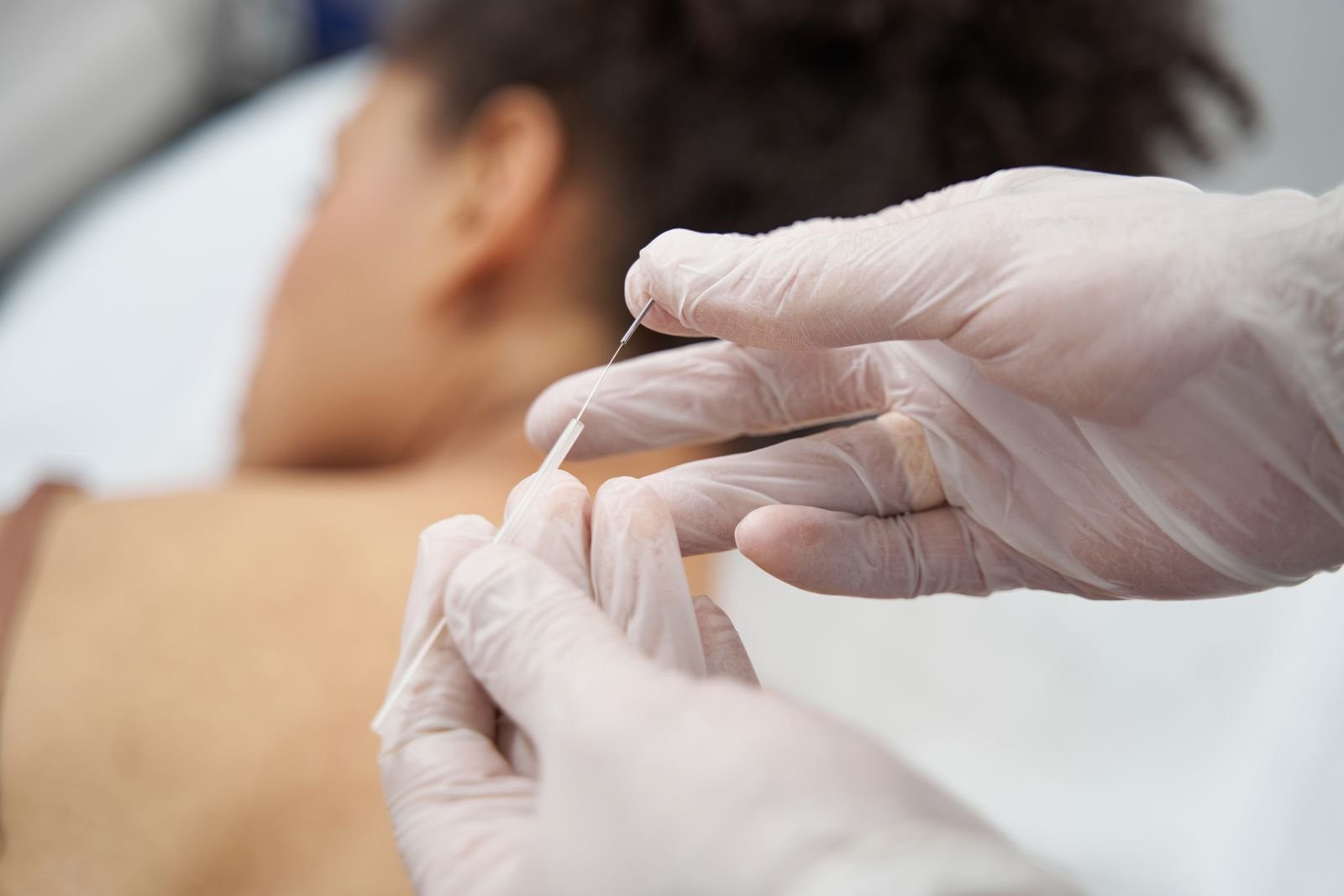 Therapist and patient during a ims and dry needling appointment in Abbotsford