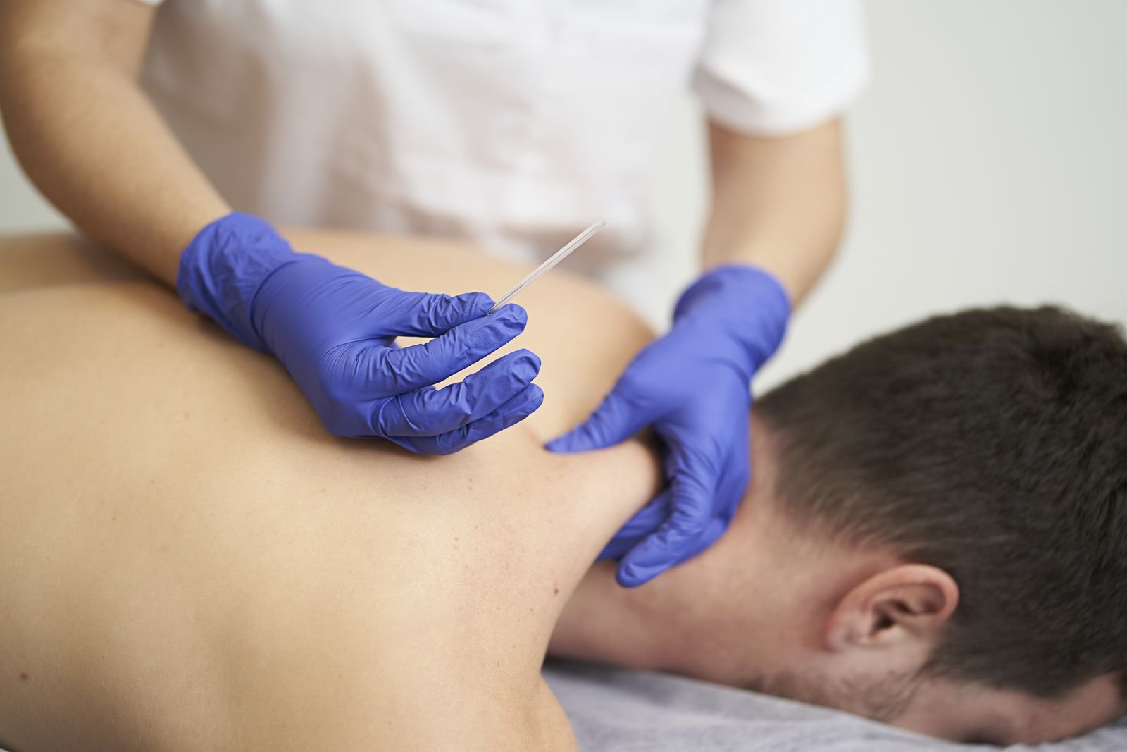 IMS and Dry Needling treatment at New Ray Physiotherapy and Health Clinic in Abbotsford